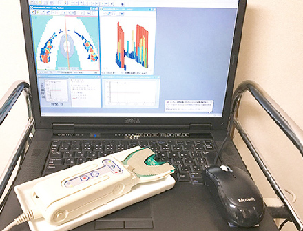 咬合接触検査装置