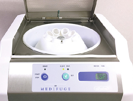 供血用遠心機(CGF生成機)
