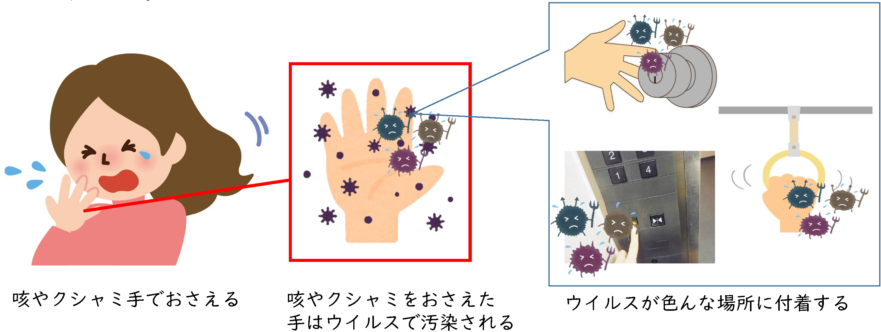 感染予防対策 ワンデイインプラント総合クリニック